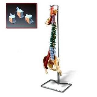 Muscle Spine W/Disorders + Stand CH5900 by Anatomical Chart Company